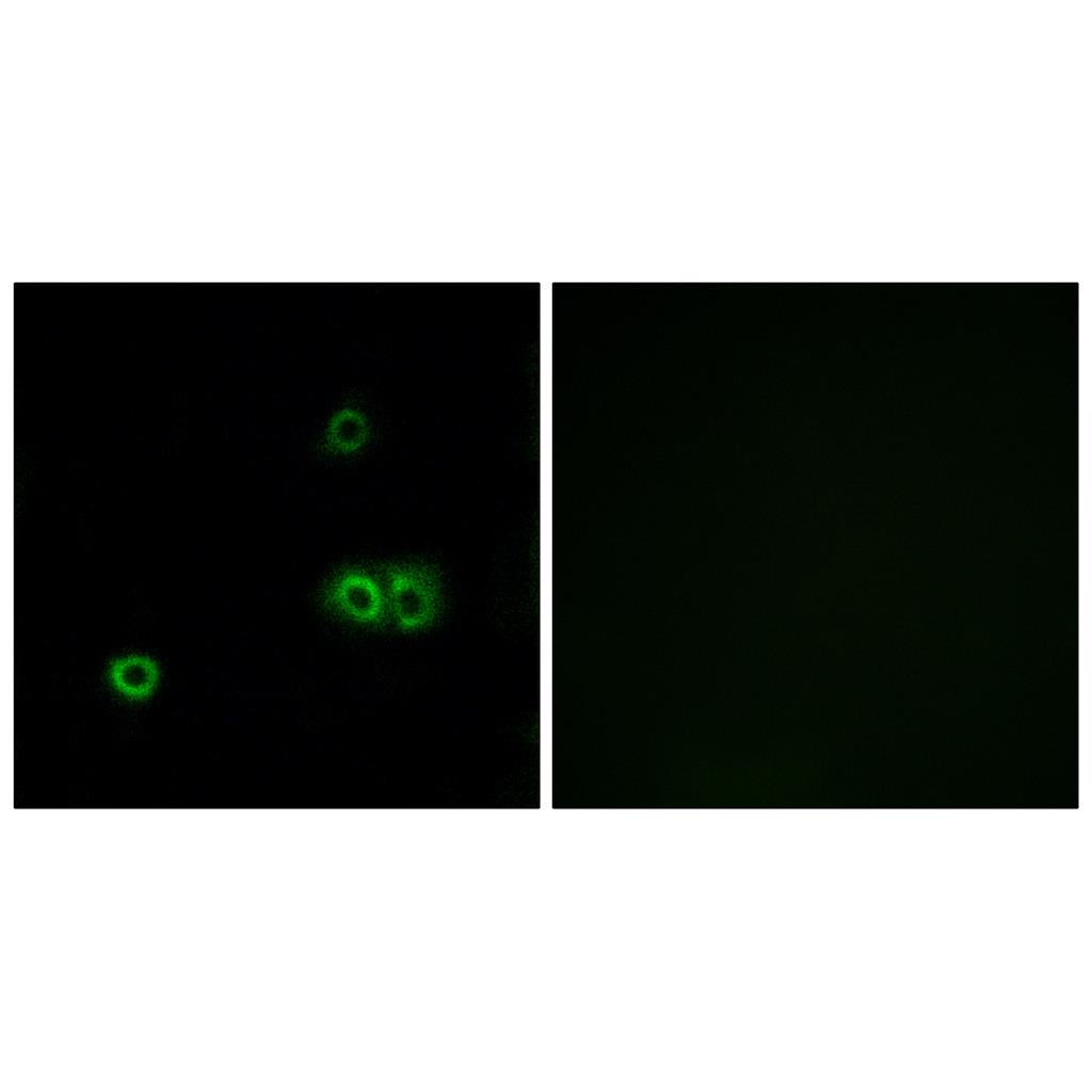 MARCH5 Rabbit Polyclonal Antibody | 兔多抗 | EnkiLife恩玑生命