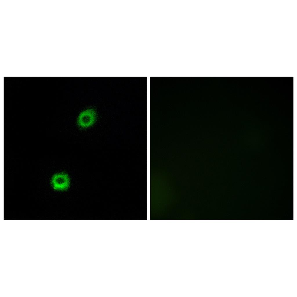 MARCKS Rabbit Polyclonal Antibody | 兔多抗 | EnkiLife恩玑生命