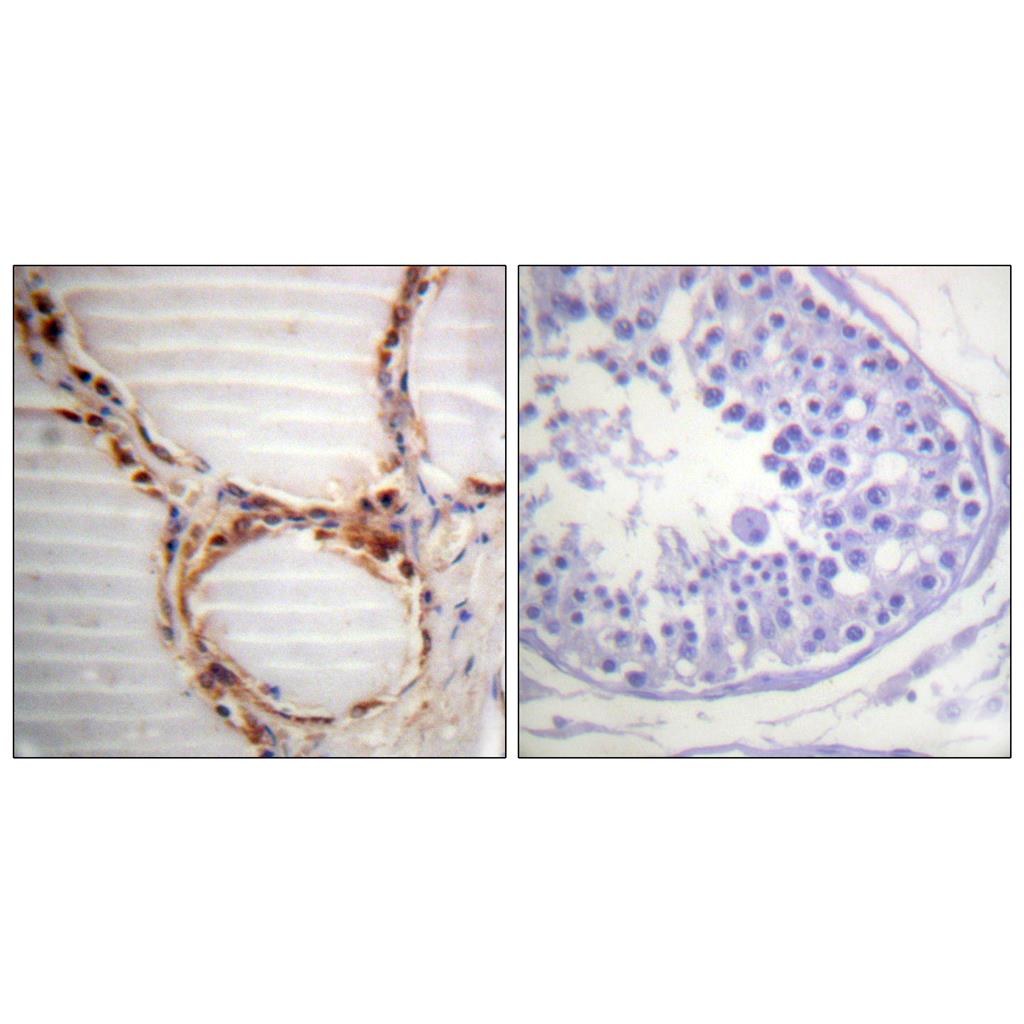 MCM4 Rabbit Polyclonal Antibody | 兔多抗 | EnkiLife恩玑生命