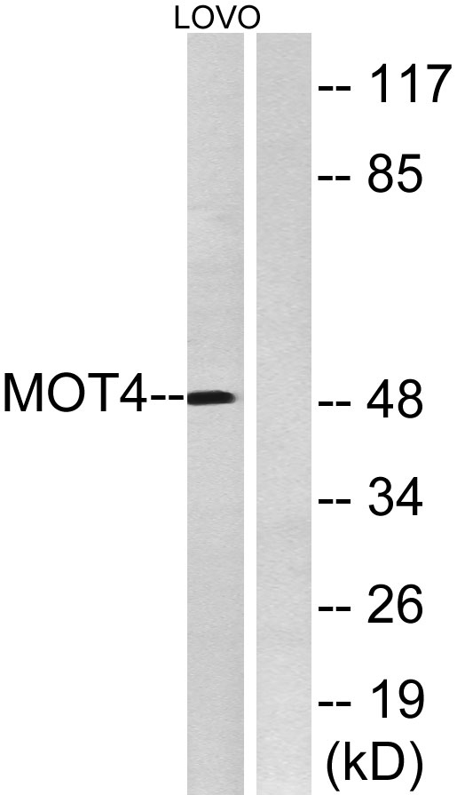 MCT4 Rabbit Polyclonal Antibody | 兔多抗 | EnkiLife恩玑生命