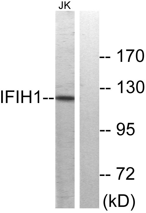 MDA5 Rabbit Polyclonal Antibody | 兔多抗 | EnkiLife恩玑生命