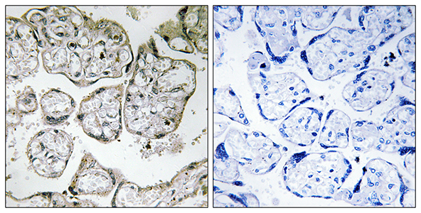 ME2 Rabbit Polyclonal Antibody | 兔多抗 | EnkiLife恩玑生命