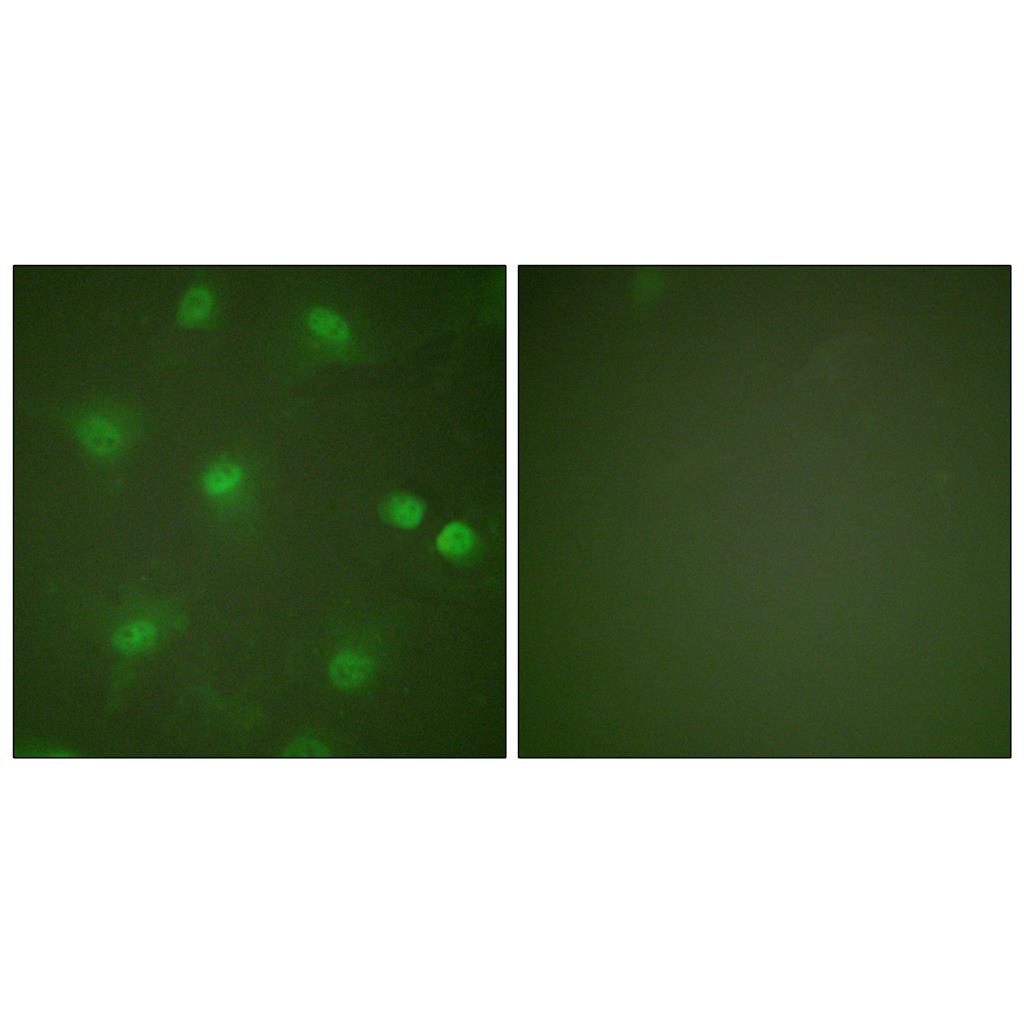 MEF-2 Rabbit Polyclonal Antibody | 兔多抗 | EnkiLife恩玑生命