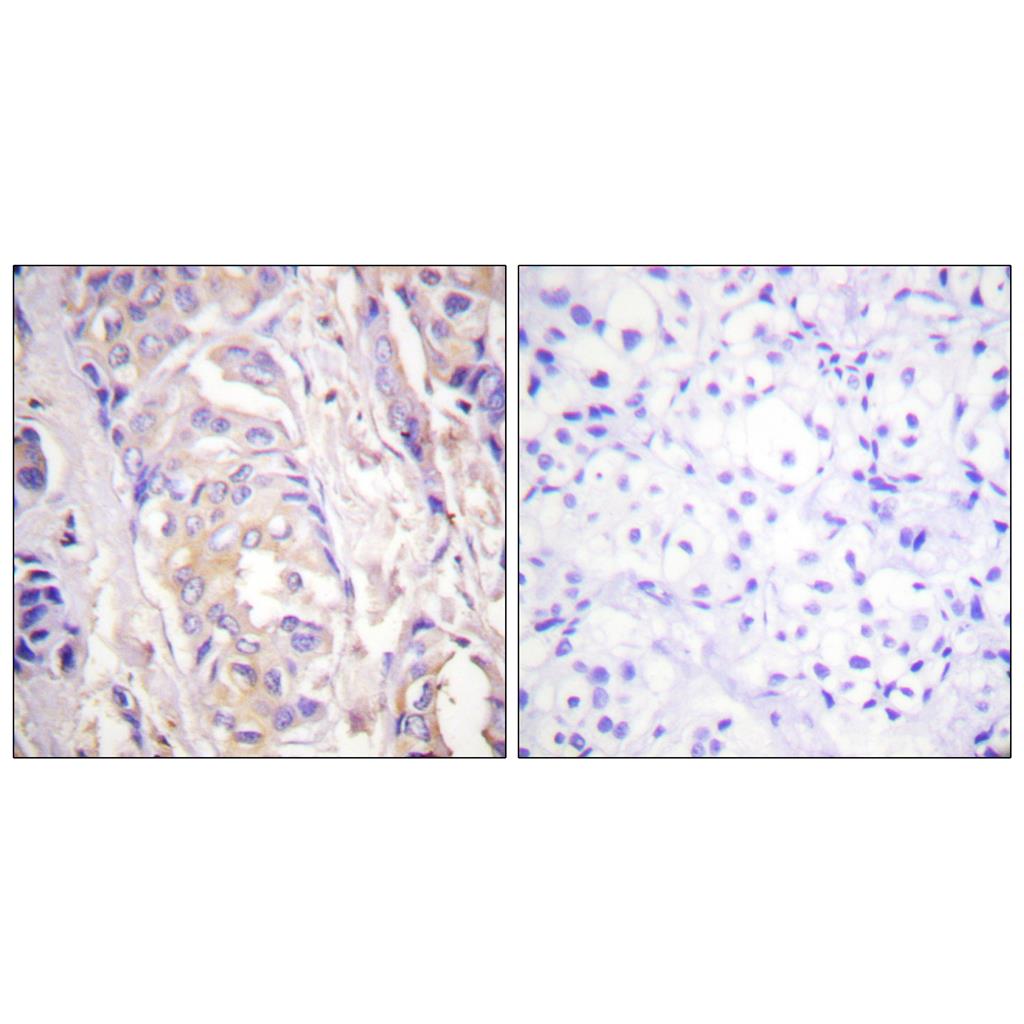 MEK-1 Rabbit Polyclonal Antibody | 兔多抗 | EnkiLife恩玑生命