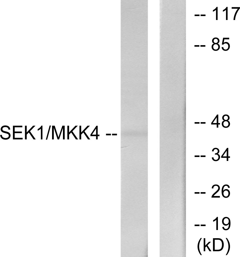 MEK-4 Rabbit Polyclonal Antibody | 兔多抗 | EnkiLife恩玑生命