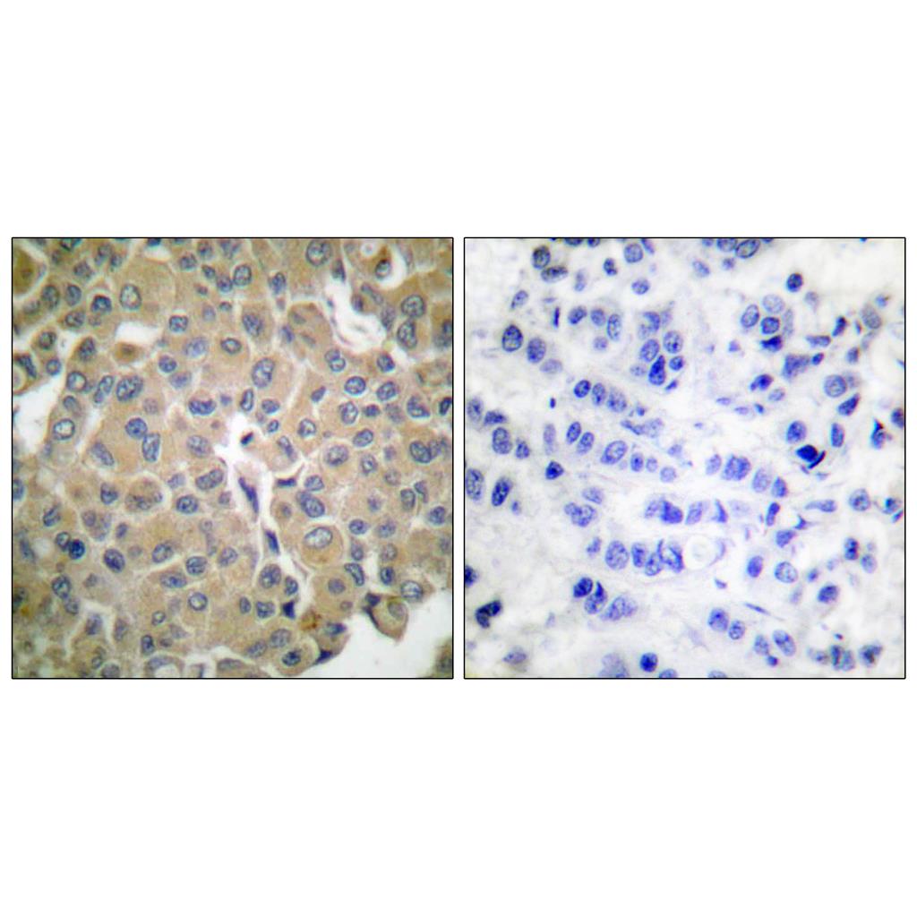 Melan-A Rabbit Polyclonal Antibody | 兔多抗 | EnkiLife恩玑生命