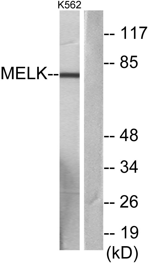 MELK Rabbit Polyclonal Antibody | 兔多抗 | EnkiLife恩玑生命