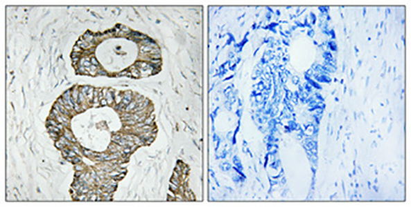 Met Rabbit Polyclonal Antibody | 兔多抗 | EnkiLife恩玑生命