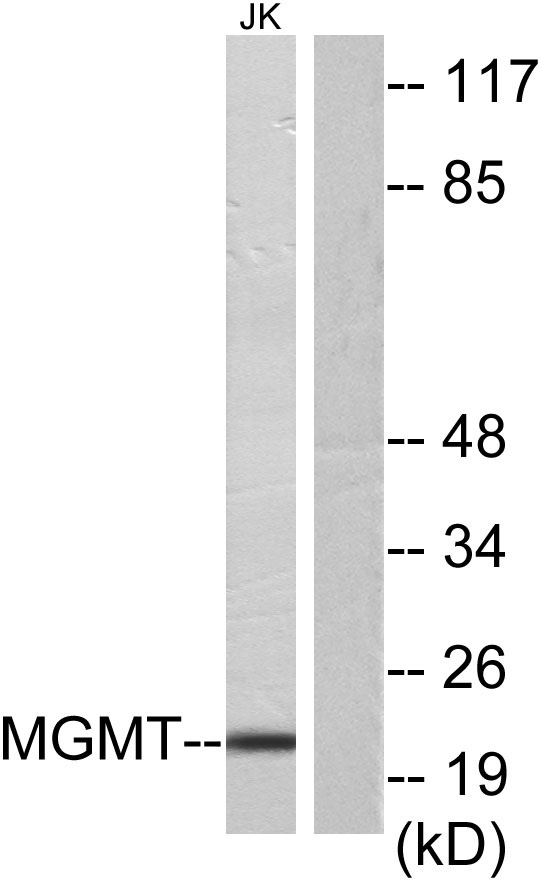 MGMT Rabbit Polyclonal Antibody | 兔多抗 | EnkiLife恩玑生命