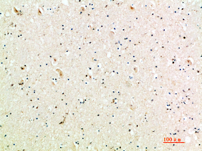 MIG Rabbit Polyclonal Antibody | 兔多抗 | EnkiLife恩玑生命