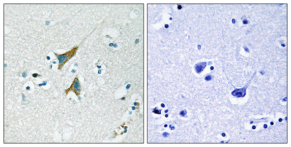 MKP-1 Rabbit Polyclonal Antibody | 兔多抗 | EnkiLife恩玑生命