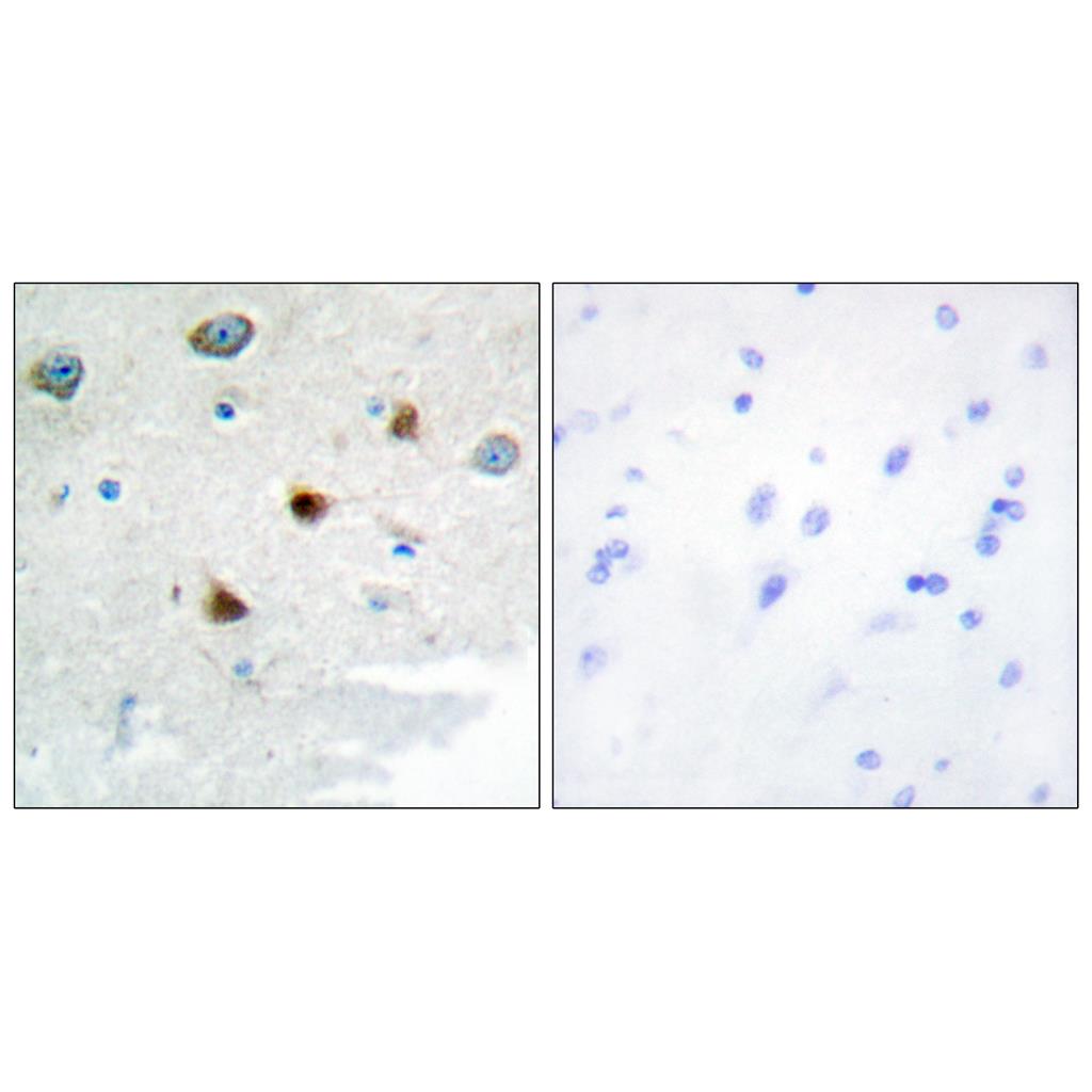 MKP-2 Rabbit Polyclonal Antibody | 兔多抗 | EnkiLife恩玑生命