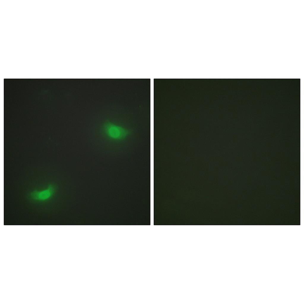 MKP-7 Rabbit Polyclonal Antibody | 兔多抗 | EnkiLife恩玑生命