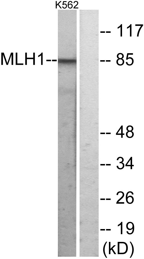 MLH1 Rabbit Polyclonal Antibody | 兔多抗 | EnkiLife恩玑生命