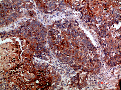 MLL Rabbit Polyclonal Antibody | 兔多抗 | EnkiLife恩玑生命
