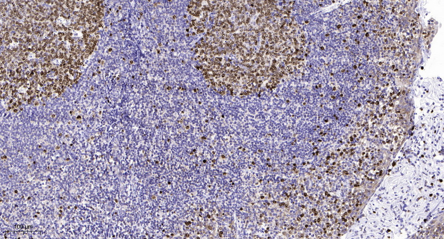 MLL4 Rabbit Polyclonal Antibody | 兔多抗 | EnkiLife恩玑生命