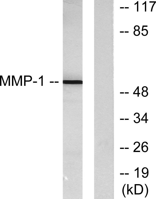 MMP-1 Rabbit Polyclonal Antibody | 兔多抗 | EnkiLife恩玑生命