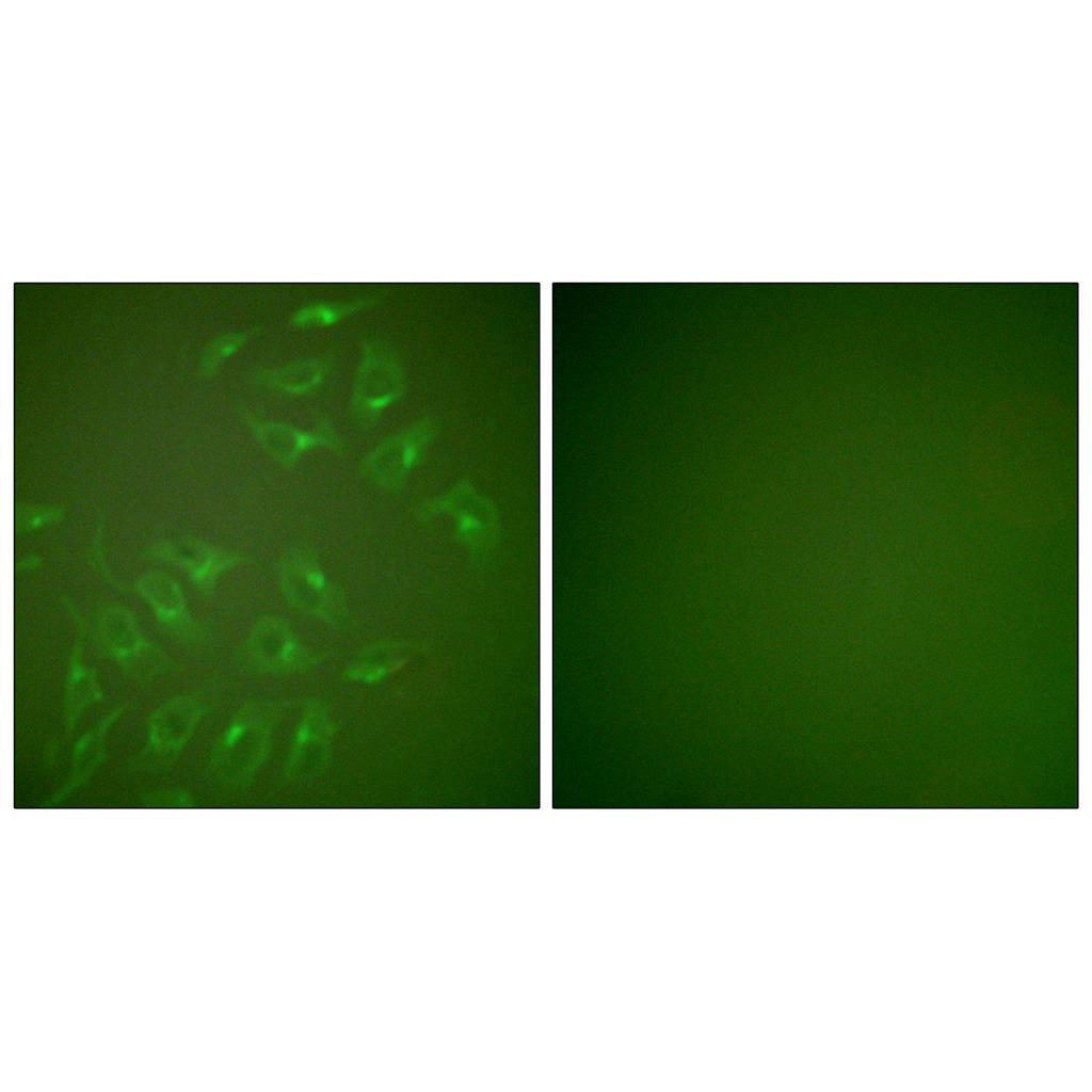 MMP-13 Rabbit Polyclonal Antibody | 兔多抗 | EnkiLife恩玑生命