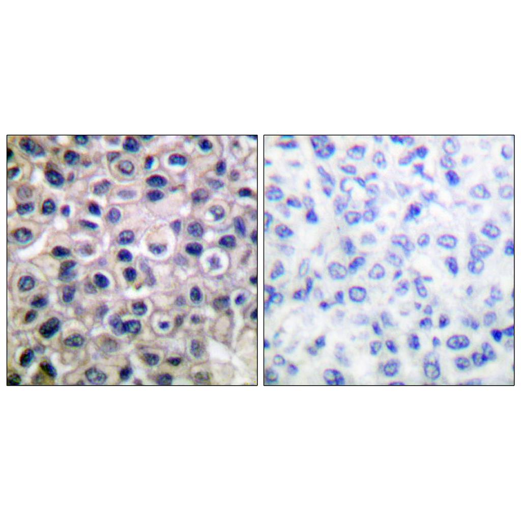 MMP-14 Rabbit Polyclonal Antibody | 兔多抗 | EnkiLife恩玑生命