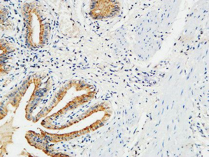 MMP-7 Rabbit Polyclonal Antibody | 兔多抗 | EnkiLife恩玑生命