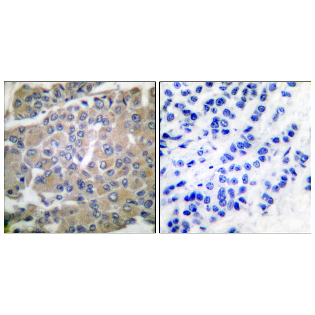 MMP-8 Rabbit Polyclonal Antibody | 兔多抗 | EnkiLife恩玑生命
