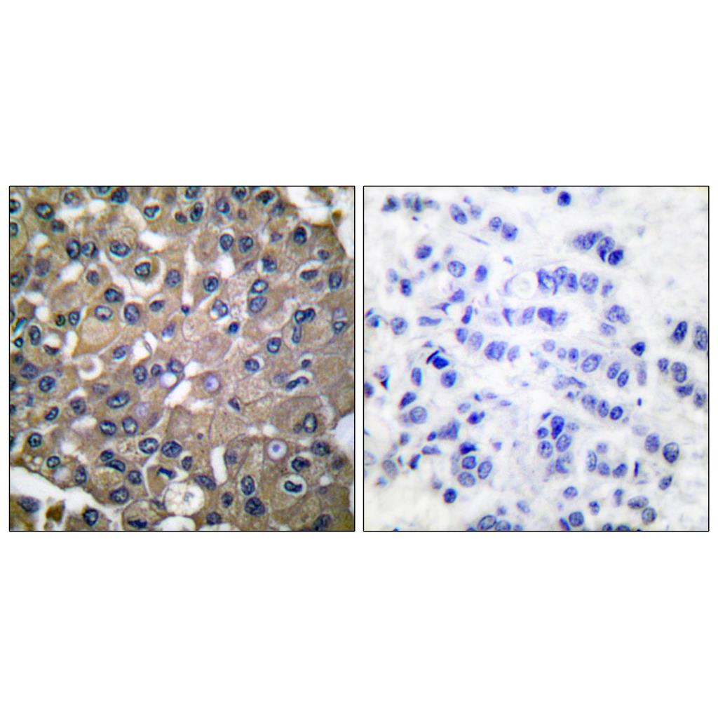 MMP-9 Rabbit Polyclonal Antibody | 兔多抗 | EnkiLife恩玑生命