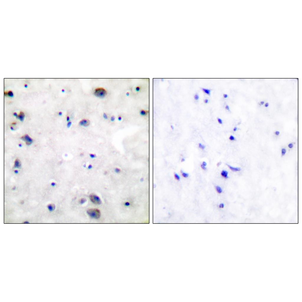 MOR-1 Rabbit Polyclonal Antibody | 兔多抗 | EnkiLife恩玑生命