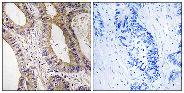 MST-3 Rabbit Polyclonal Antibody | 兔多抗 | EnkiLife恩玑生命