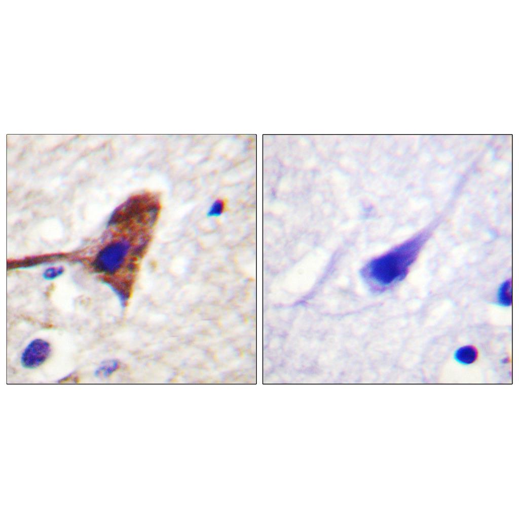 mTOR Rabbit Polyclonal Antibody | 兔多抗 | EnkiLife恩玑生命