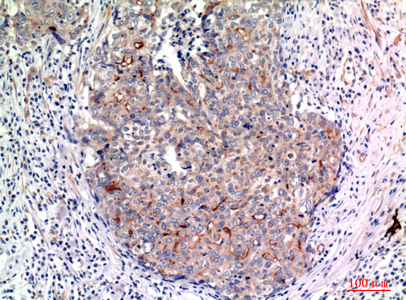 Mucin 1 Rabbit Polyclonal Antibody | 兔多抗 | EnkiLife恩玑生命