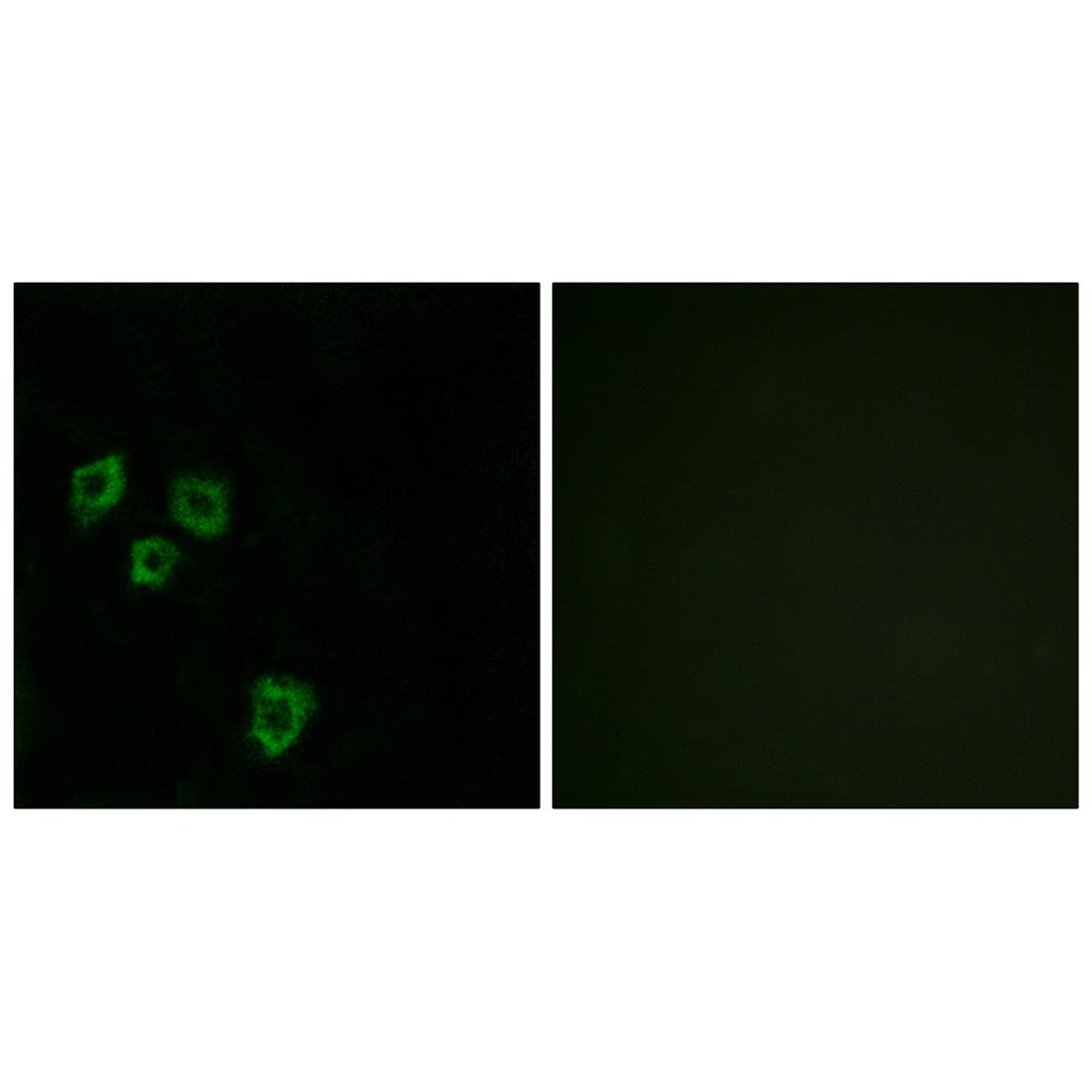 Mucin 16 Rabbit Polyclonal Antibody | 兔多抗 | EnkiLife恩玑生命