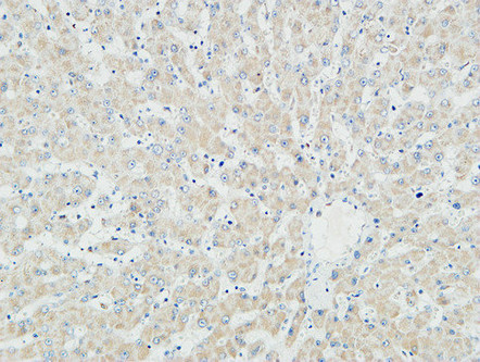 Myogenin Rabbit Polyclonal Antibody | 兔多抗 | EnkiLife恩玑生命