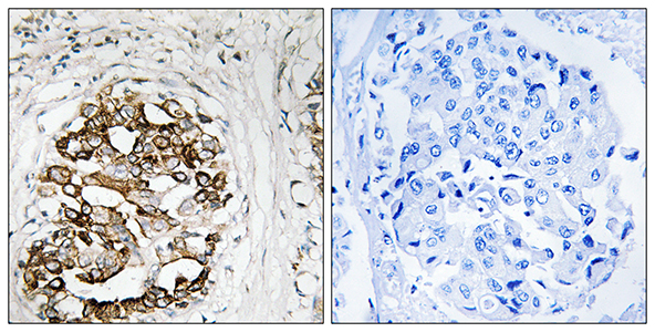 Myt 1 Rabbit Polyclonal Antibody | 兔多抗 | EnkiLife恩玑生命