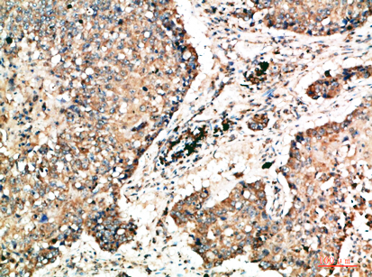 Napsin A Rabbit Polyclonal Antibody | 兔多抗 | EnkiLife恩玑生命