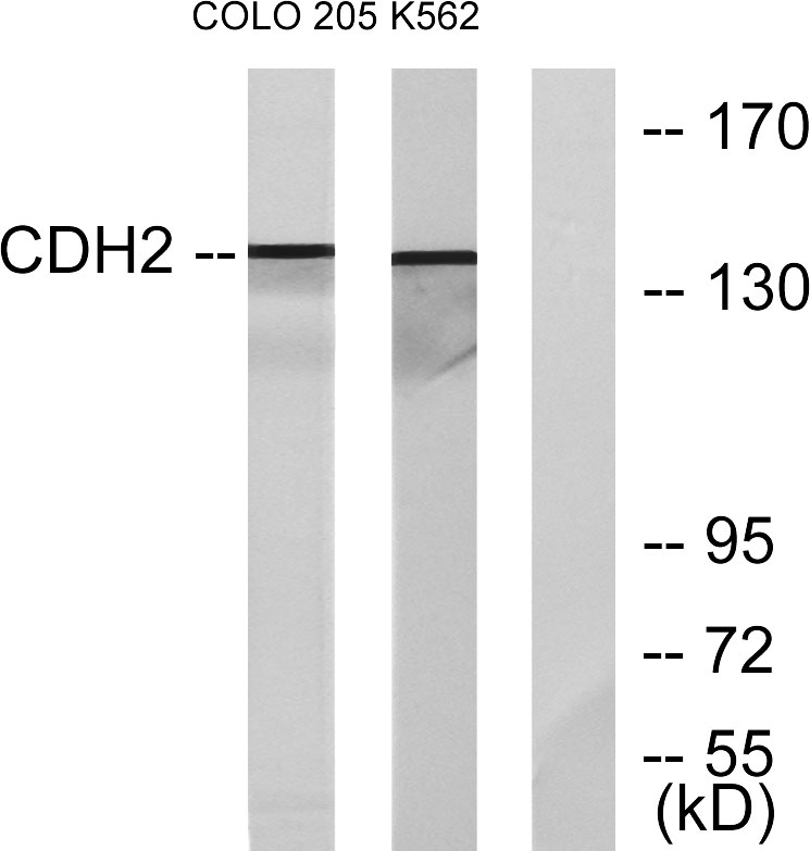 N-cadherin Rabbit Polyclonal Antibody | 兔多抗 | EnkiLife恩玑生命
