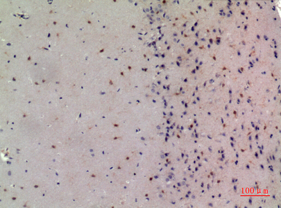 NCoA-3 Rabbit Polyclonal Antibody | 兔多抗 | EnkiLife恩玑生命