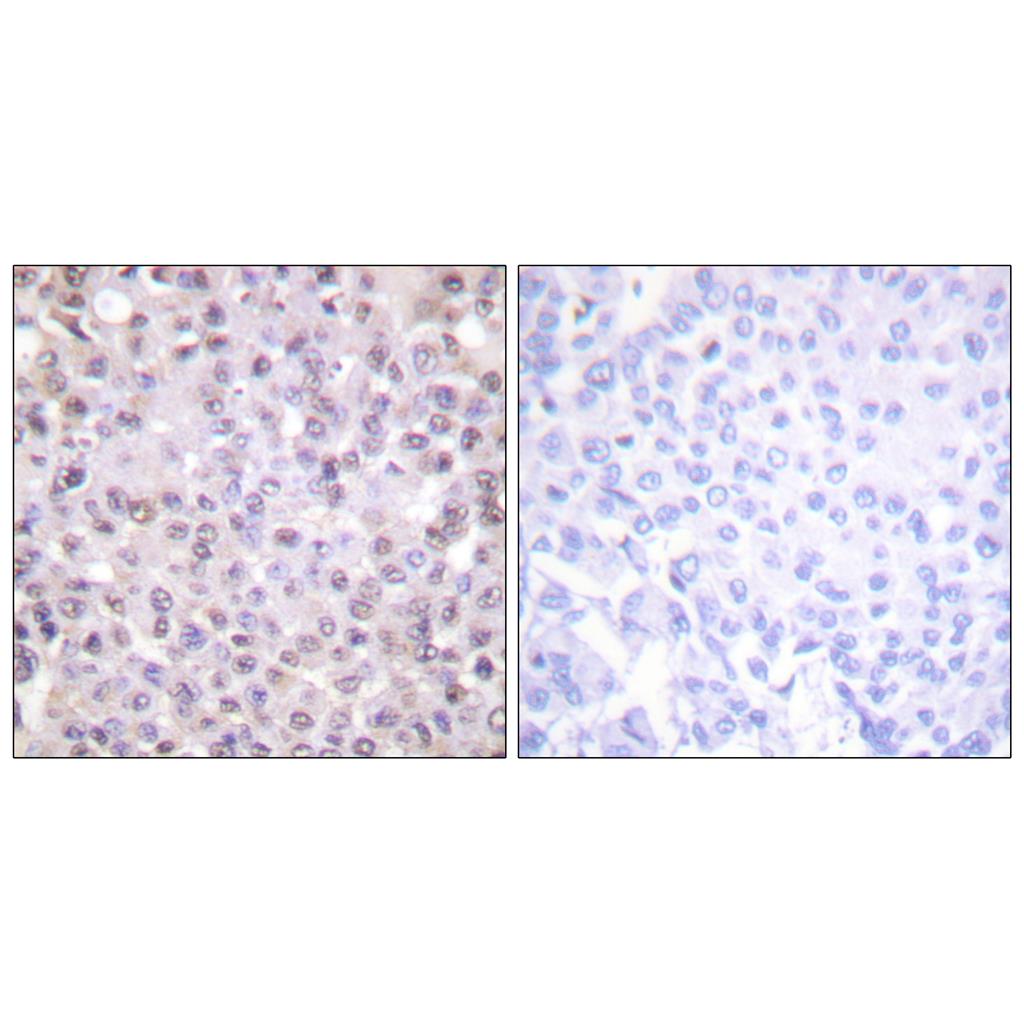 N-CoR Rabbit Polyclonal Antibody | 兔多抗 | EnkiLife恩玑生命