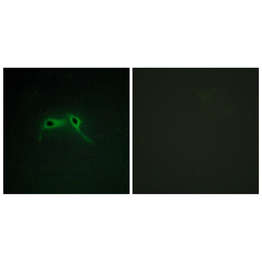 Neurofibromin Rabbit Polyclonal Antibody | 兔多抗 | EnkiLife恩玑生命