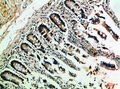 NFATc2 Rabbit Polyclonal Antibody | 兔多抗 | EnkiLife恩玑生命