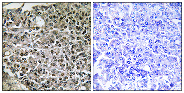 NFATc4 Rabbit Polyclonal Antibody | 兔多抗 | EnkiLife恩玑生命