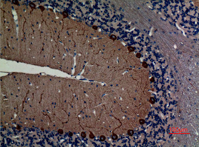 NF-L Rabbit Polyclonal Antibody | 兔多抗 | EnkiLife恩玑生命