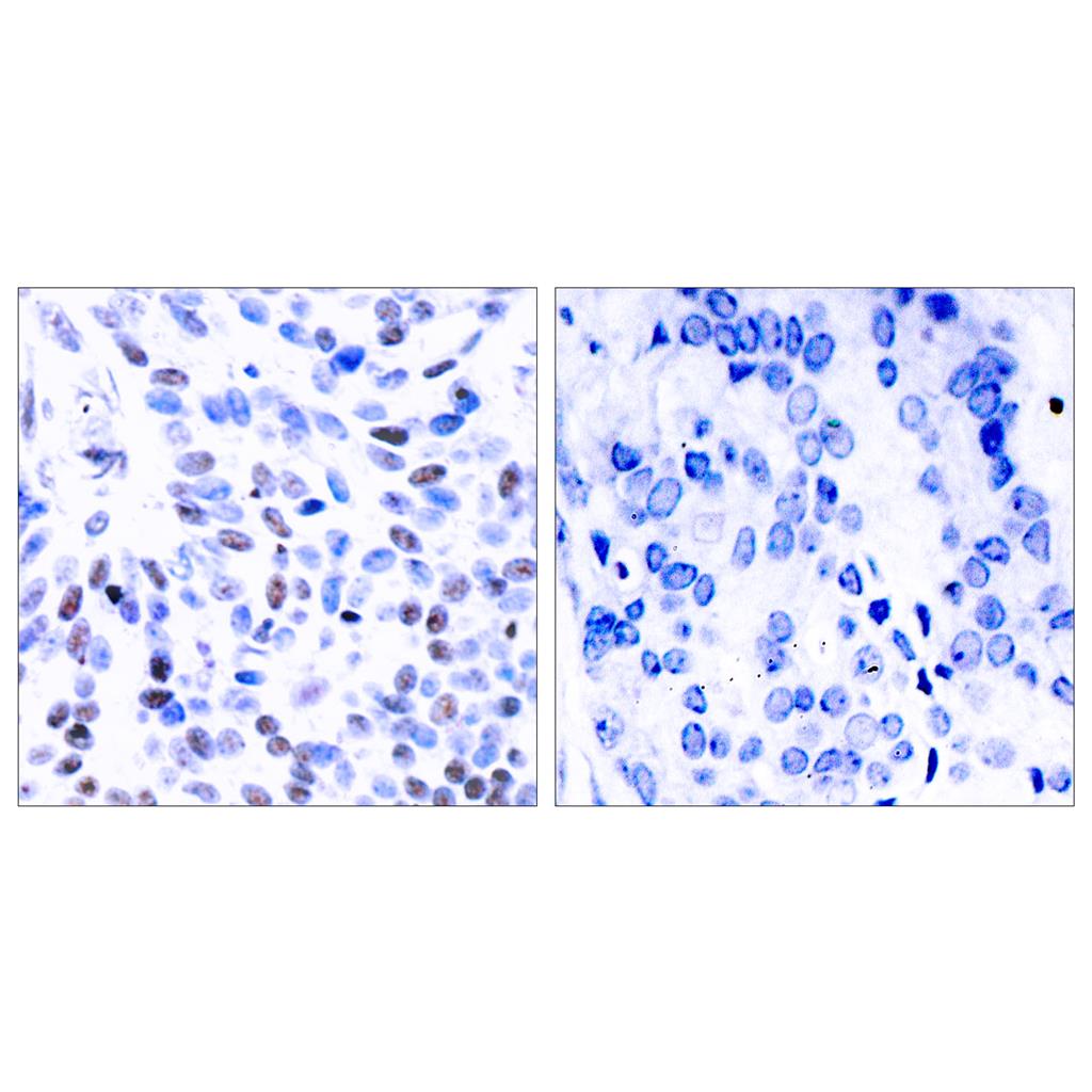 NFκB-p100 Rabbit Polyclonal Antibody | 兔多抗 | EnkiLife恩玑生命
