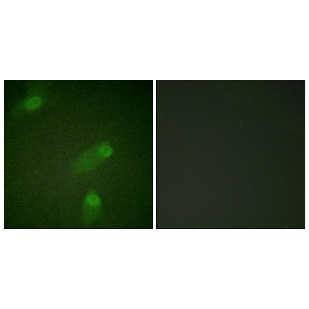 NFκB-p105 Rabbit Polyclonal Antibody | 兔多抗 | EnkiLife恩玑生命