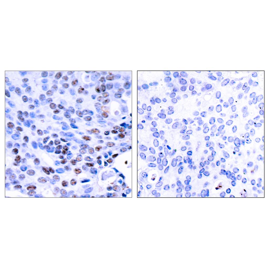 NFκB-p105/p50 Rabbit Polyclonal Antibody | 兔多抗 | EnkiLife恩玑生命