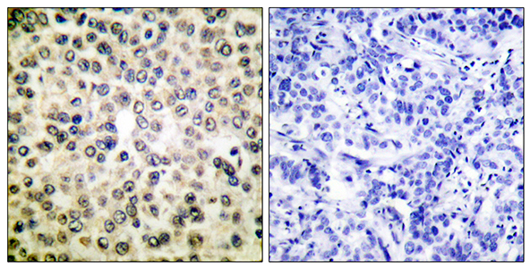 NFκB-p65 Rabbit Polyclonal Antibody | 兔多抗 | EnkiLife恩玑生命