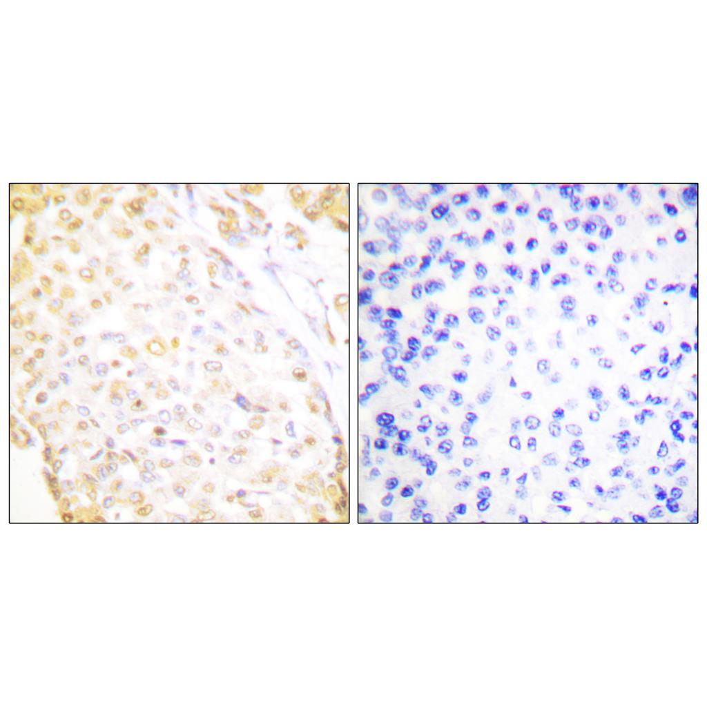 Nkx-3.1 Rabbit Polyclonal Antibody | 兔多抗 | EnkiLife恩玑生命