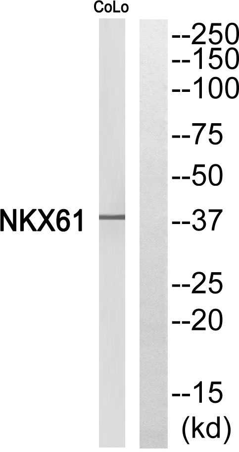 Nkx-6.1 Rabbit Polyclonal Antibody | 兔多抗 | EnkiLife恩玑生命