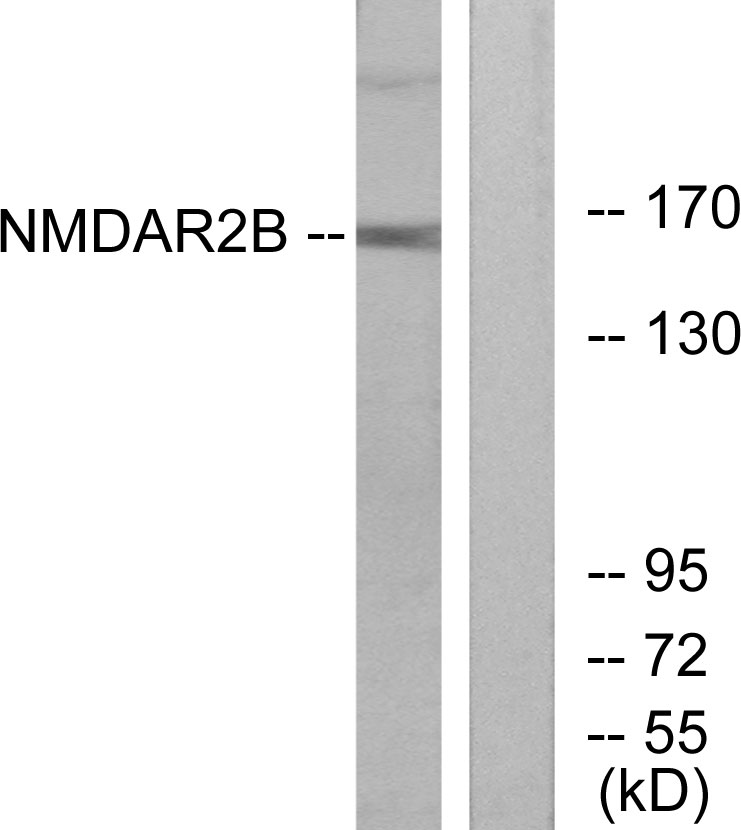 NMDAε2 Rabbit Polyclonal Antibody | 兔多抗 | EnkiLife恩玑生命