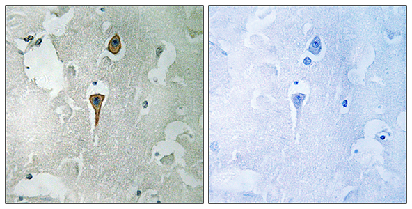 NMDAζ1 Rabbit Polyclonal Antibody | 兔多抗 | EnkiLife恩玑生命