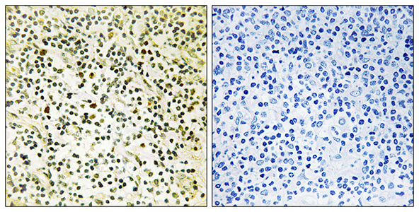 NPM Rabbit Polyclonal Antibody | 兔多抗 | EnkiLife恩玑生命